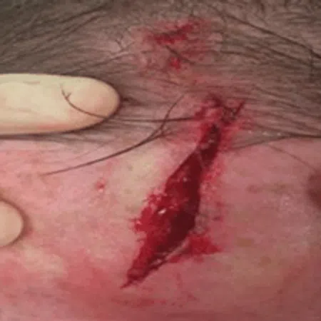 Ondersteunend beeld bij het artikel