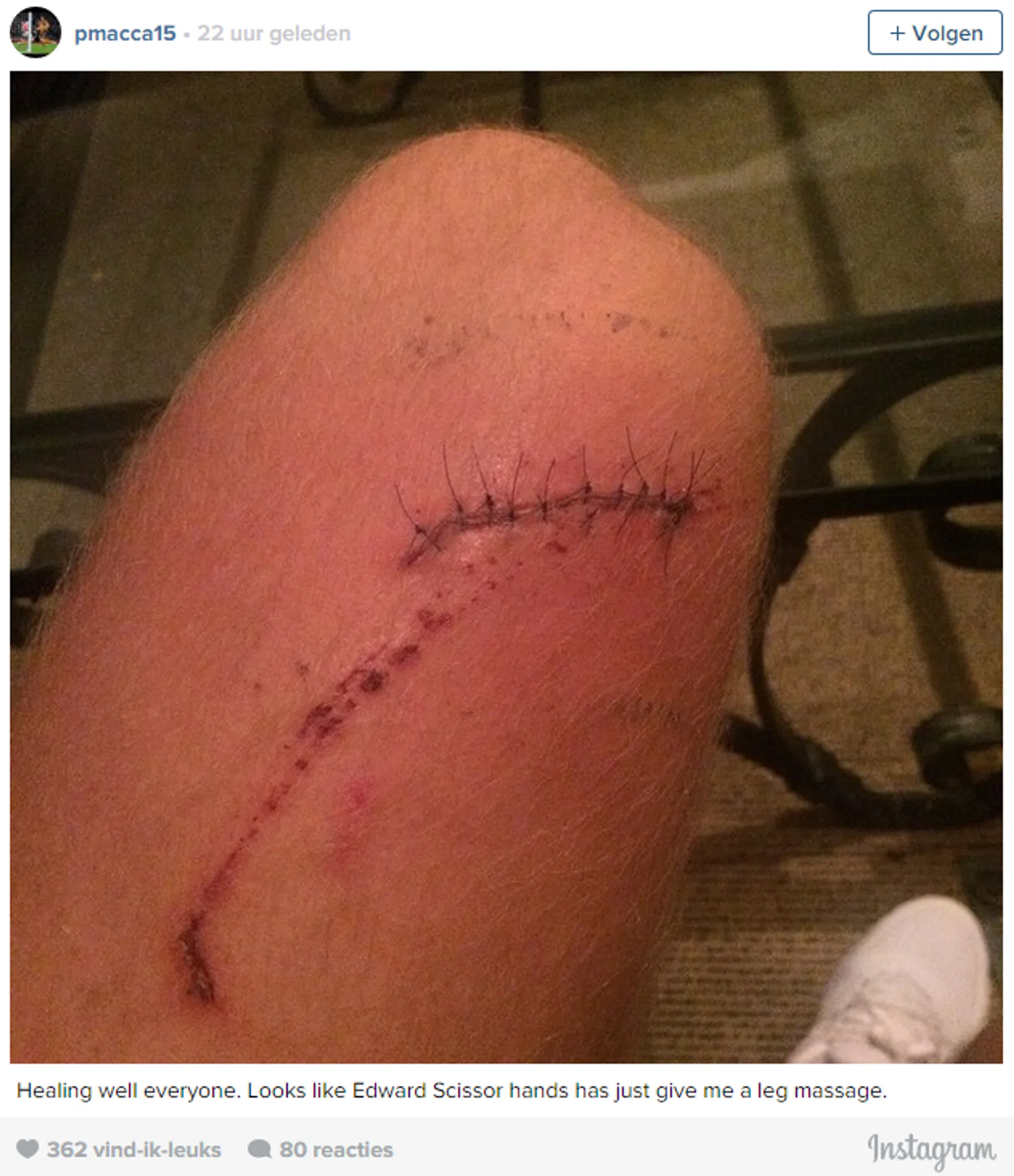 Ondersteunend beeld bij het artikel