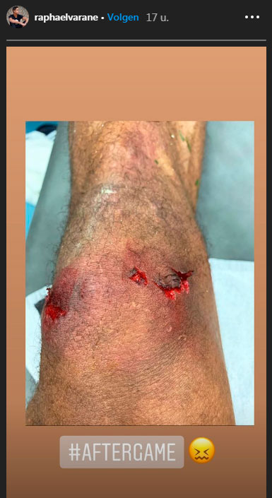 Ondersteunend beeld bij het artikel