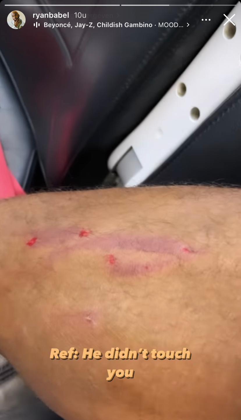 Ondersteunend beeld bij het artikel