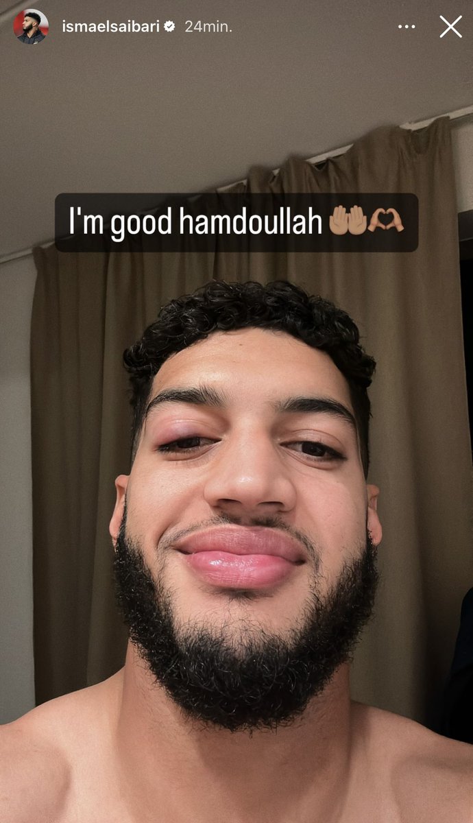 Ondersteunend beeld bij het artikel