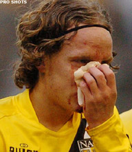 Gebroken neus houdt Stam aan de kant