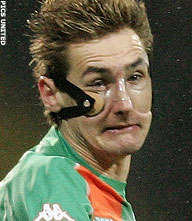 Miroslav Klose voorzichtig met jukbeen