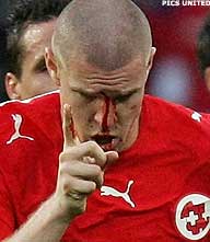 Philippe Senderos toch onder het mes