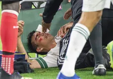 Thumbnail for article: Napoli meldt na akelige botsing goed nieuws over Lozano