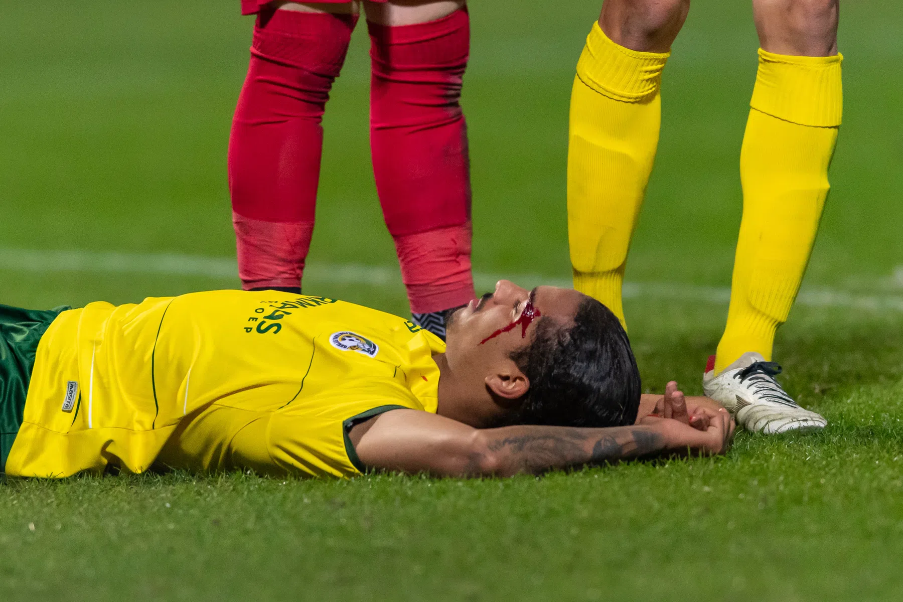 Fortuna Sittard en het geluk van een gescheurde wenkbrauw