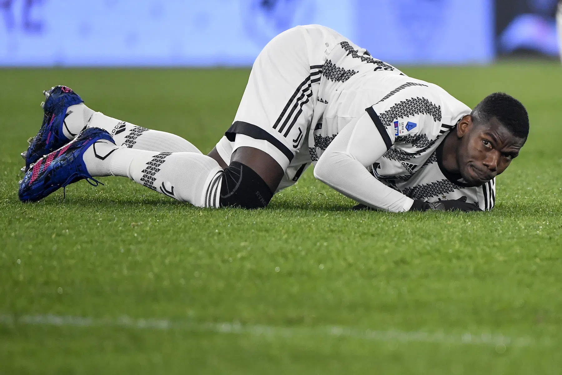 Opmerkelijke blessure zorgt nog meer Pogba-frustratie bij Juventus