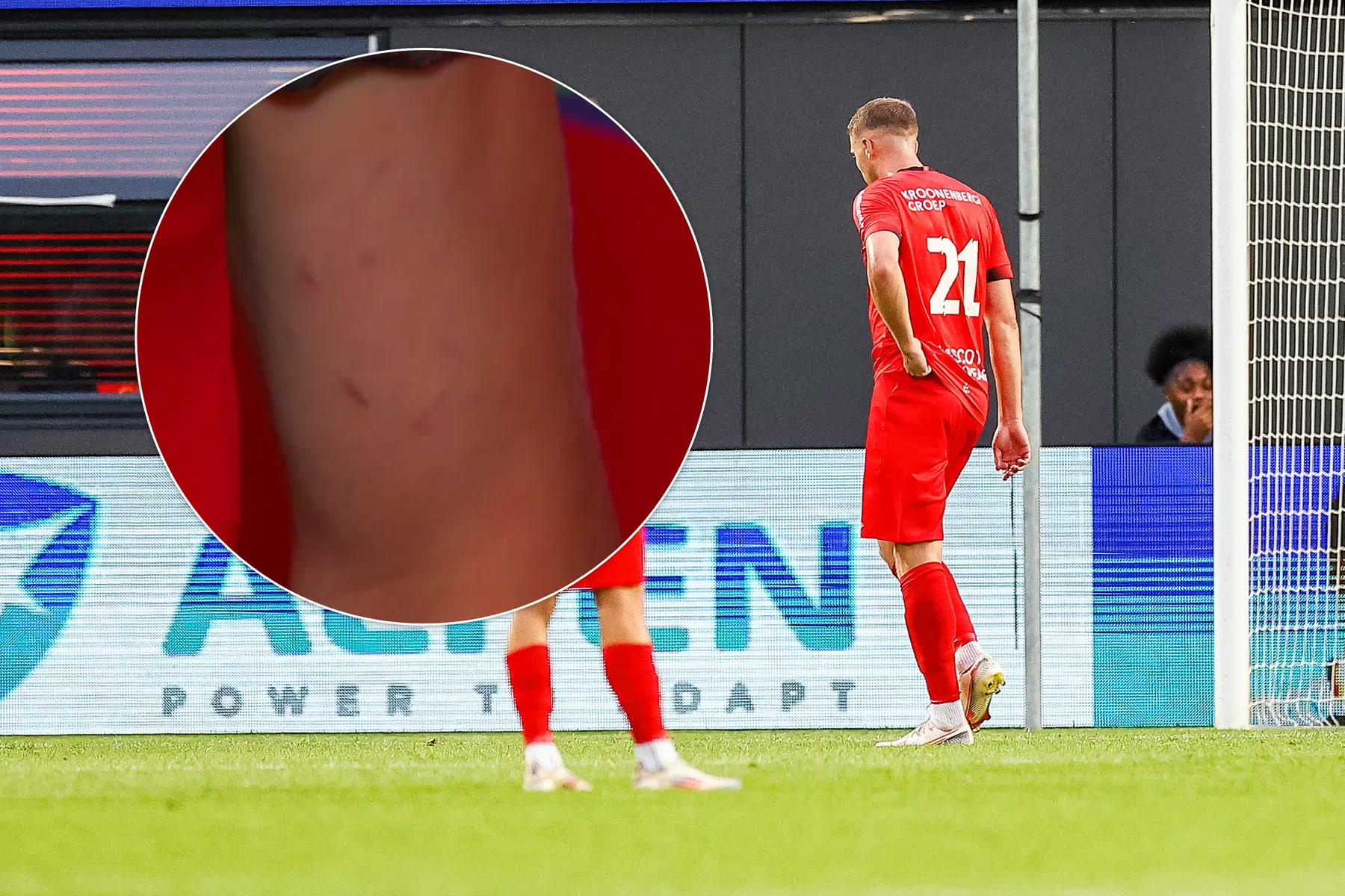 Dader verklaart natrappen via krassen op zijn arm