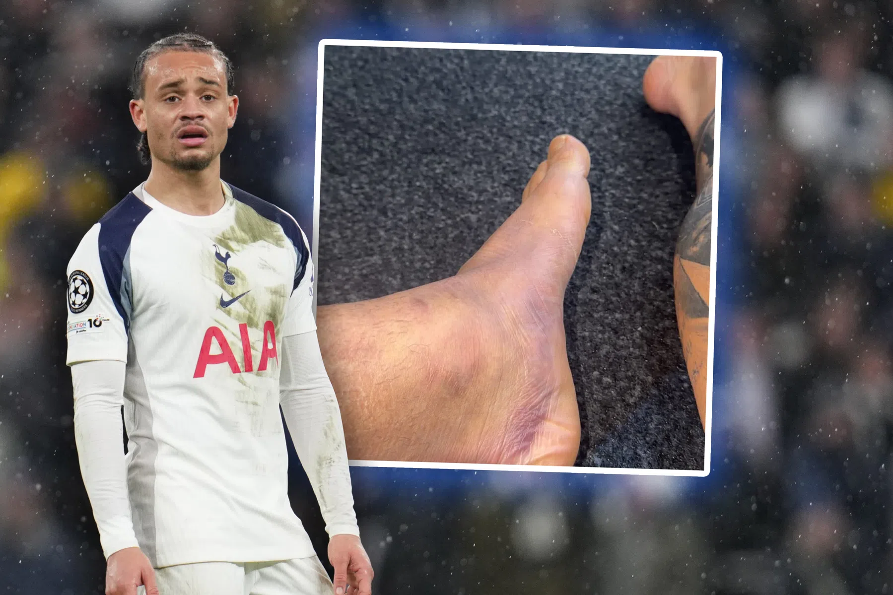 Xavi Simons deelt foto van gezwollen voet na CL-zege op Dortmund