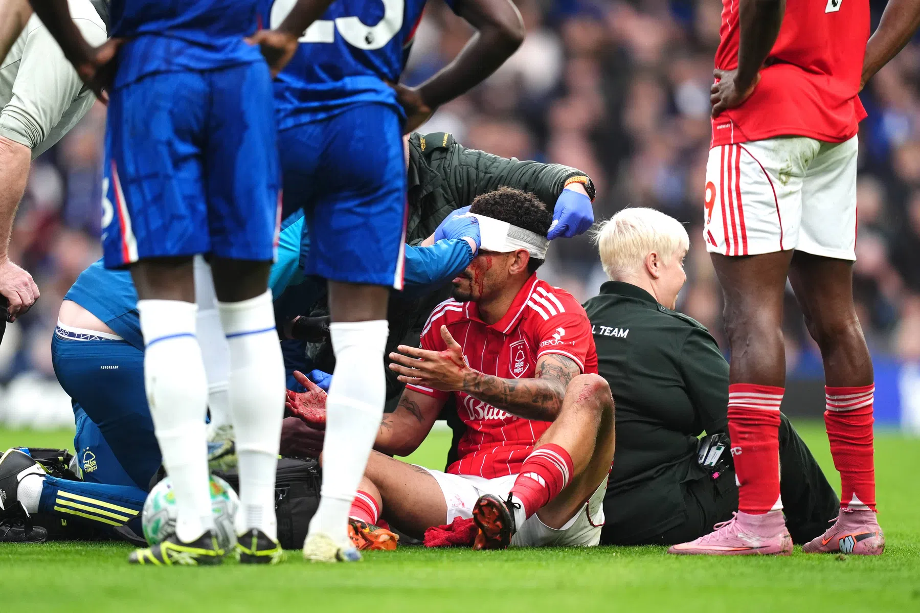 Nottingham-spits Gibbs-White toont flinke gezichtswond na botsing op Stamford Brid